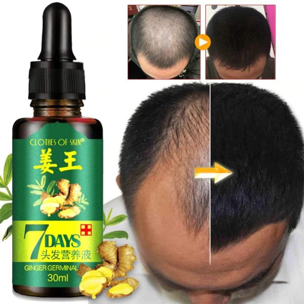 GINGER GERMINAL OIL FOR FAST HAIR GROWTH